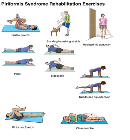 258) Piriformis Syndrome - Home Stretches & Exercises 